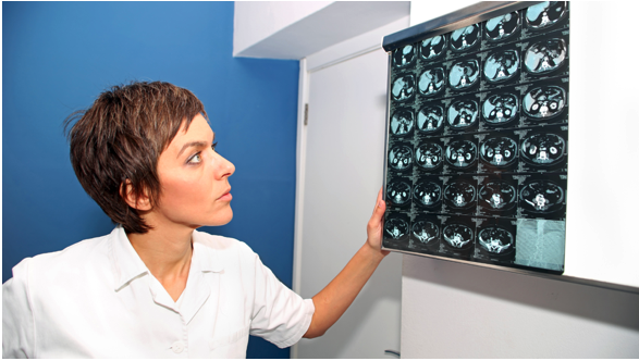 Village Medical doctor examining types of cysts in a CT scan